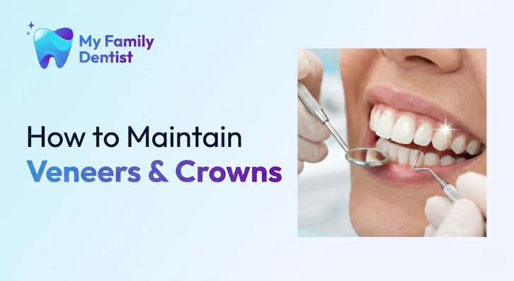 How to Maintain Veneers & Crowns