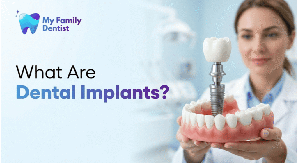 What Are Dental Implants?