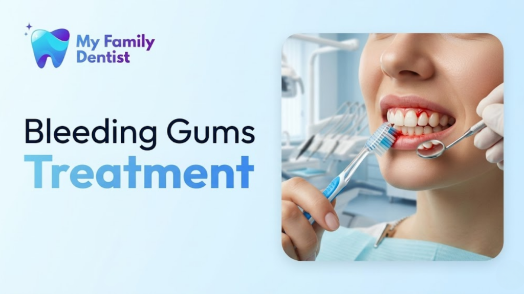 Bleeding Gums Treatment: Causes, Remedies & When to See a Dentist