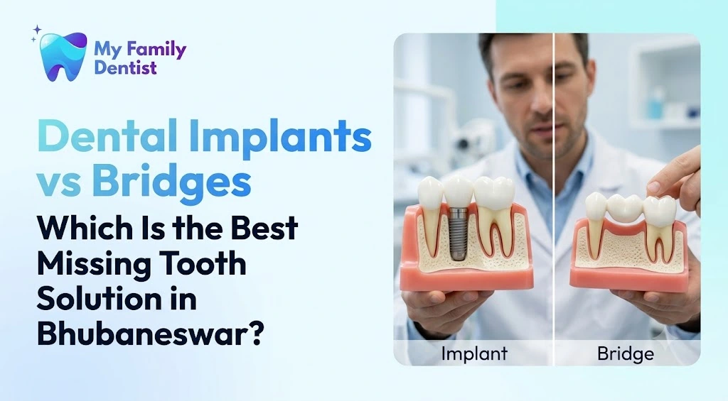 Dental Implants vs Bridges: Which Is the Best Missing Tooth Solution in Bhubaneswar?