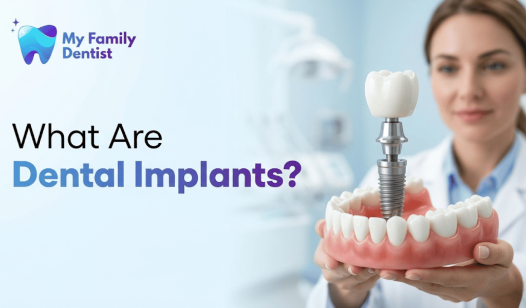 what are dental implants explained for beginners