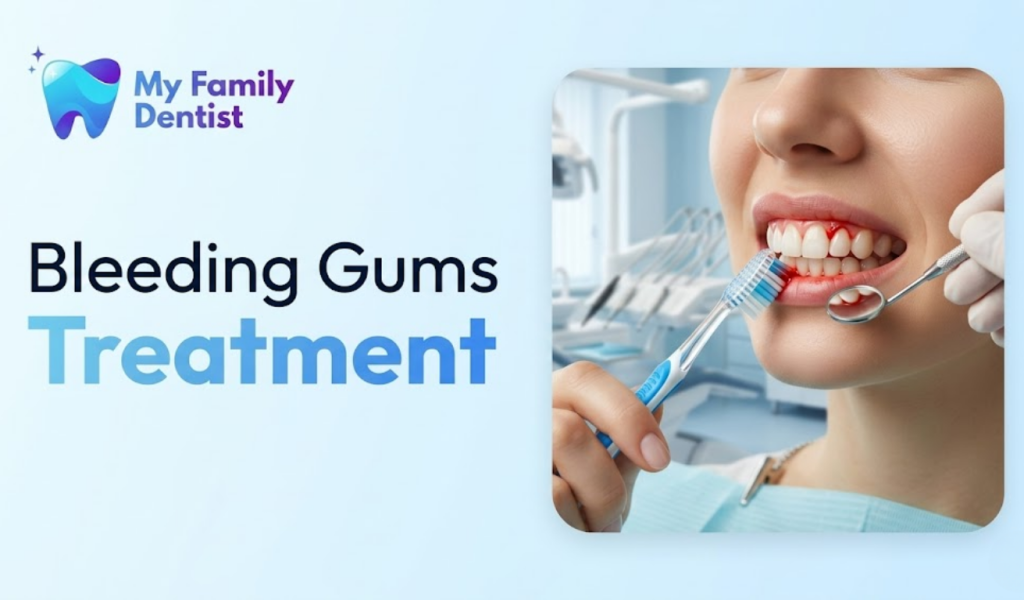 Bleeding gums treatment and professional dental cleaning for gum health